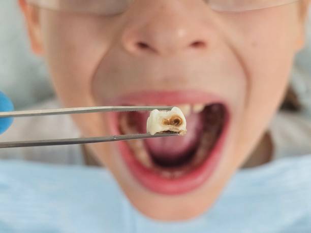Best Holiday Emergency Dentist in Manhattan, KS